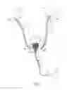 Fig. 08 - Catheter device and method for inducing negative pressure in a patient's bladder
