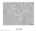 Fig. 24 - Catheter device and method for inducing negative pressure in a patient's bladder