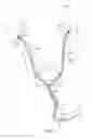 Fig. 02 - Ureteral and bladder catheters and methods of inducing negative pressure to increase renal perfusion