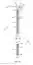 Fig. 04 - Ureteral and bladder catheters and methods of inducing negative pressure to increase renal perfusion