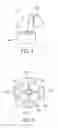 Fig. 05 - Ureteral and bladder catheters and methods of inducing negative pressure to increase renal perfusion