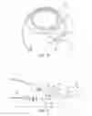 Fig. 09 - Ureteral and bladder catheters and methods of inducing negative pressure to increase renal perfusion