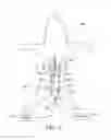 Fig. 16 - Ureteral and bladder catheters and methods of inducing negative pressure to increase renal perfusion