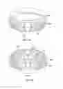 Fig. 06 - GUIDE WIRE RESTRAINT DEVICE