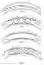 Fig. 03 - Curved passageway conforming balloon catheter with nested balloons