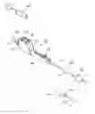 Fig. 01 - Sinus balloon catheter with adjustable bending angle and balloon position