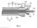 Fig. 04 - Balloon catheter