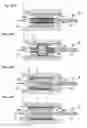 Fig. 05 - Balloon catheter