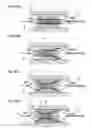 Fig. 07 - Balloon catheter