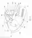 Fig. 14 - Antiseptic applicator