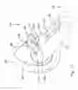 Fig. 18 - Antiseptic applicator