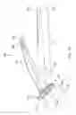 Fig. 19 - Antiseptic applicator