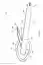 Fig. 14 - Antiseptic applicator