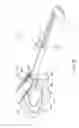 Fig. 15 - Antiseptic applicator