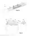 Fig. 03 - Features in increased surface area on neuromodulation leads