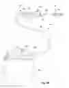 Fig. 04 - Features in increased surface area on neuromodulation leads