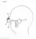 Fig. 03 - Glasses-shaped cochlear implant device
