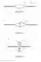 Fig. 11 - Retracting lifeline systems for use in tie-back anchoring