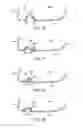 Fig. 17 - Golf club with flexure