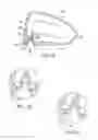 Fig. 25 - Golf club with flexure