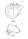 Fig. 42 - Golf club with flexure
