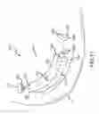 Fig. 12 - Golf club head having an adjustable weighting system
