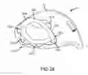 Fig. 22 - Golf club head having an adjustable weighting system