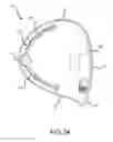 Fig. 26 - Golf club head having an adjustable weighting system