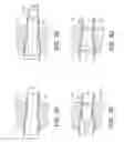 Fig. 03 - Composite column for use in high pressure liquid chromatography