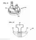 Fig. 07 - Filter housing with filter key attachment