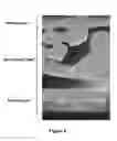 Fig. 09 - Functionalized membranes for bioartificial organs