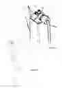 Fig. 13 - Fluid reservoir and dispensing device
