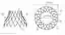 Fig. 01 - Methods for stent shaping