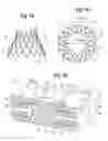 Fig. 02 - Methods for stent shaping