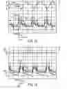 Fig. 12 - Welding wire feeder power control system and method