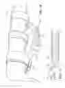 Fig. 17 - Lighting device for a sport utility vehicle or utility task vehicle