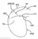 Fig. 01 - Passenger side airbag