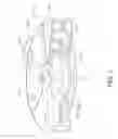 Fig. 03 - Separable buoy