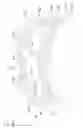 Fig. 06 - Non-removable closure cap with a collar