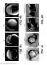 Fig. 09 - Novel Ezrin Inhibitors and Methods of Making and Using