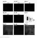 Fig. 02 - Chemical reprogramming of human glial cells into neurons with small molecule cocktail