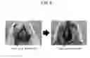 Fig. 07 - Cell culture method using bone marrow-like structure, and porous polyimide film for healing bone injury site