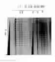 Fig. 07 - High fidelity restriction endonucleases