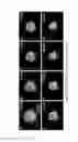 Fig. 02 - Technique for aggregating macromolecules together with cells