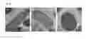 Fig. 06 - Mutant having ability to overproduce carotenoids and method for producing carotenoids by using same