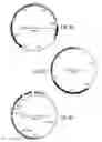 Fig. 16 - Engineered bacteria for production and release of therapeutics