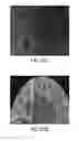 Fig. 48 - CNS TARGETING AAV VECTORS AND METHODS OF USE THEREOF