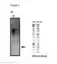Fig. 02 - Recombinant microorganism for improved production of fine chemicals