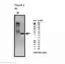 Fig. 04 - Recombinant microorganism for improved production of fine chemicals
