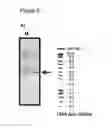 Fig. 06 - Recombinant microorganism for improved production of fine chemicals